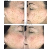 Nerds. - Hyperpigmentation Serum - 2% Alpha Arbutin + 1% Kojic Acid - Serum na Przebarwienia - 2% Alfa-Arbutyna + 1% Kwas Kojowy - 30ml