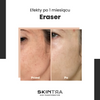 SkinTra - Eraser - Serum na Przebarwienia z Witaminą C 10% - 30ml OUTLET